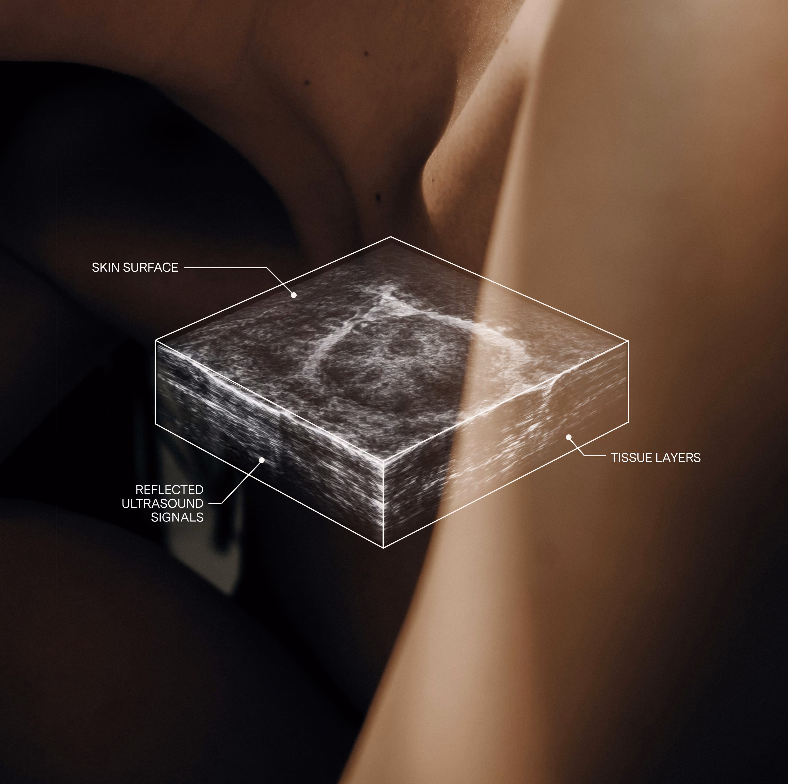 Illustrated 3D block of ultrasound imagery lifted from a woman's chest, with callouts labeling the skin surface, tissue layers, and reflected ultrasound signals